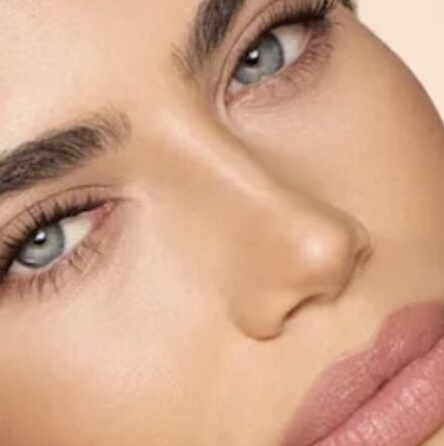 What is Laser Scar Removal? 