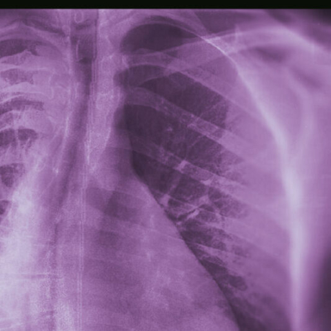 Manchester Producer Werkha Explores Scoliosis in His New Album